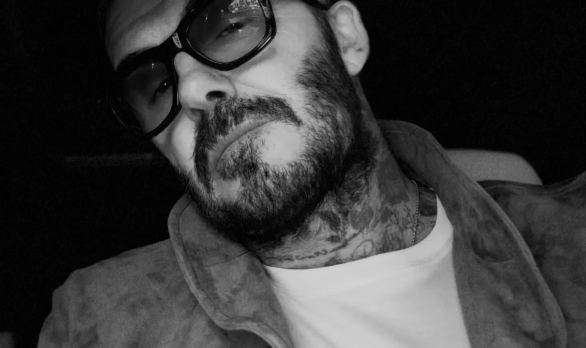 David Beckham with a slightly swollen face after dental work.